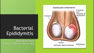 Bacterial Epididymitis [upl. by Leakim53]