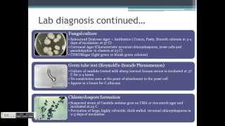 CANDIDIASIS  Clinical Manifestations and lab diagnosis of oral candidiasis [upl. by Ellatnahc]