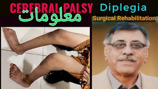 Spastic Cerbral Palsy Diplegia Detailed overview  Surgical and Rehabilitation Treatment Pathways [upl. by Schaffel]