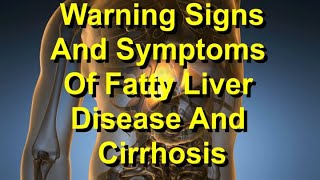 Warning Signs And Symptoms Of Fatty Liver Disease And Cirrhosis [upl. by Netsud501]