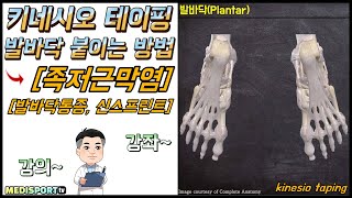 키네시오 테이핑 발바닥 족저근막 족저근막염 활액막염 근막염 신스프린트 해결방법  kinesio tape plantar fasciitis plantar pain [upl. by Ralli794]