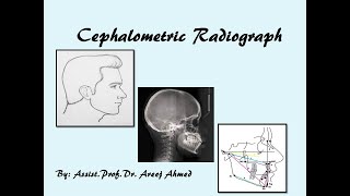 Cephalometric Radiograph [upl. by Daniele]