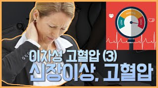 고혈압이유 신장의 문제로 고혈압생기는 병 Medullary Sponge Kidney [upl. by Htebzil235]