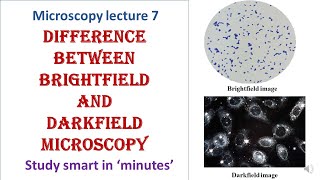 Differences between Brightfield and Darkfield microscopy  Microscopy lecture 7 [upl. by Eul890]