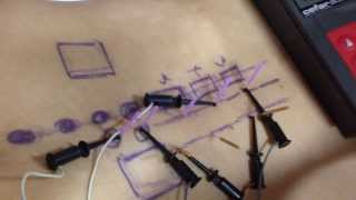 Dry Needling for Low Back Pain  Dry Needling Courses for Dry Needling Certification [upl. by Claudia]