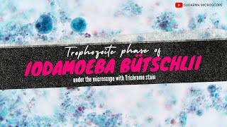 Trophozoite phase of Iodamoeba bütschlii under the microscope with Trichrome stain [upl. by Smitty118]