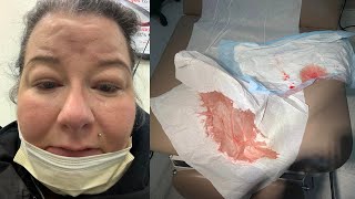 BARTHOLIN’S CYST REMOVAL amp RECOVERY  MOST PAIN EVER part 1 [upl. by Yna]