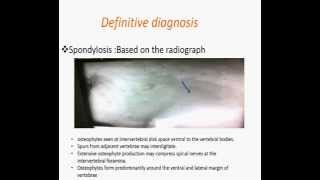 Spondylosis deformans [upl. by Sidalg234]