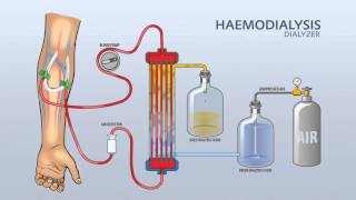 HAEMODIALYSIS DIALYZER [upl. by Daphene95]