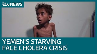 Yemens starving now face worlds worst cholera outbreak  ITV News [upl. by Tunk506]