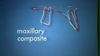 901 Composite Cephalometric Tracing Technique [upl. by Goodspeed]