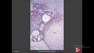 Histology Of Organs Chapter 20 B Endocrine System [upl. by Latrice]