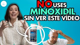 🔴 DERMATOLOGA te EXPLICA como APLICARTE MINOXIDIL ¿Efectos secundarios shedding Dra Pilar Ochoa [upl. by Enrobialc41]