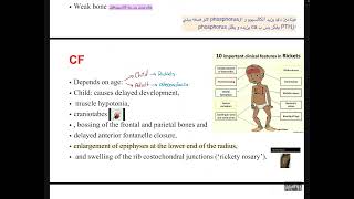 MBD4osteoporosis and osteomalacia [upl. by Ronni]