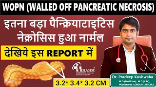 पेन्क्रियाटाइटिस  WOPN  स्यूडोसिस्ट  Collection  Necrosis  treatment  cure कैसे ठीक करें [upl. by Koralie330]