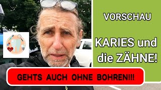 VORSCHAU KARIES und die ZÄHNE Gehts auch ohne Bohren und Zahnarzt [upl. by Aleciram]