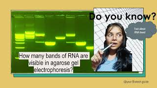 How to interpret RNA BANDS in agarose gel electrophoresis [upl. by Idet]