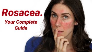 Why Does Everyone Get Rosacea Wrong What It Is and How to Treat It [upl. by Hcurab329]