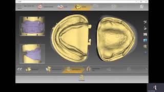 InLab SW20 Denture Teeth Workflow [upl. by Ecinrev997]