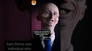 Sam Berns A Legacy of Resilience and Joy ❤️🔥 lifejourney successstory inspiration ytshorts [upl. by Phillida153]