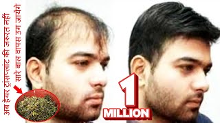 अब Hair Transplant की जरूरत नहीं सारे बाल वापस उग जायेंगे 100 गारंटी  प्राचीन जड़ी बूटी [upl. by Tedd]