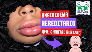 ANGIOEDEMA HEREDITARIO [upl. by Costin]