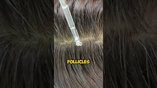 Hair Loss This Blood Test Is the 1 Thing You’re Missing [upl. by Atinehc]