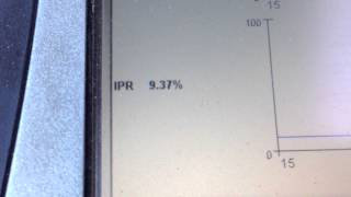 P1211 lack of power on a Ford 73 powerstroke diesel Due to oil [upl. by Hull]