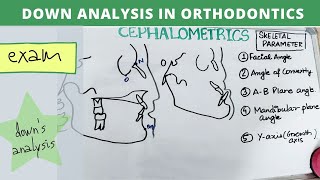 downs analysis orthodontics  dental lectures [upl. by Rosmarin]