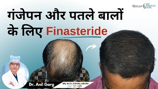 गंजेपन और पतले बालों के लिए Finasteride  FINASTERIDE क्या होता है  Right Dose Of Finasteride [upl. by Sirraj65]