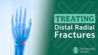 Treating Distal Radius Fractures at Dartmouth Health [upl. by Ahsyek826]