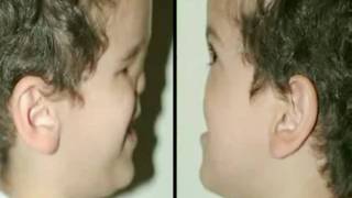 Boy Born With Half A Face SHOCKING Saddest VIDEO [upl. by Kenna]