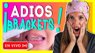 🎥𝐑𝐄𝐓𝐈𝐑𝐎 𝐝𝐞 𝐎𝐑𝐓𝐎𝐃𝐎𝐍𝐂𝐈𝐀 en 𝒗𝒊𝒗𝒐 Como se 𝗤𝗨𝗜𝗧𝗔𝗡 los BRACKETS y se ponen los RETENEDORES ORTODONCIA🔥 [upl. by Ettennaej406]