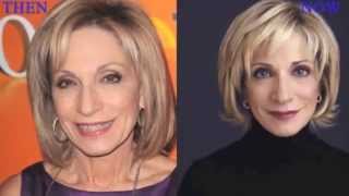 Andrea Mitchell Before and After Plastic Surgery Photos [upl. by Springer]