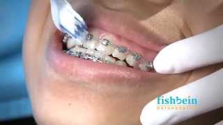 Orthodontic Home Care Instructions  Braces  Brushing [upl. by Hannahs]