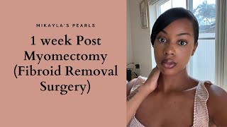 1 week Post Myomectomy Fibroid Removal Surgery [upl. by Alaehcim]