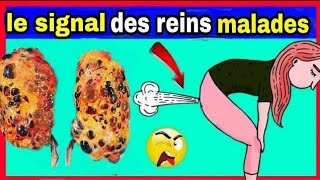 7 SIGNES DES REINS MALADES MAIS LE PIRE CEST QUE TOUT LE MONDE NE LE SAIT PAS [upl. by Rebliw430]