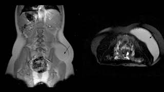 Difference Between Hyperventilation and Tachypnea [upl. by Araf]