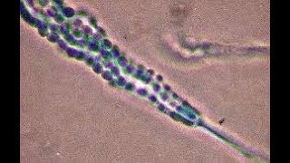 Penicillium cheresanum showing single celled conidia [upl. by Arramas584]