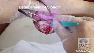 Explanation of Wound Dressings by Skilled Wound Care Dr Bardia Anvar MD [upl. by Bore136]