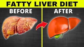 Fatty Liver Diet 5 BEST Foods and 5 To DITCH Meal Plan [upl. by Allys10]