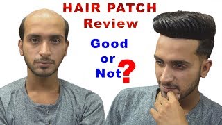 Hair patch review after 1 year Good or not [upl. by Betthezul]