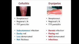 cellulitis vs erysipelas [upl. by Scherle]