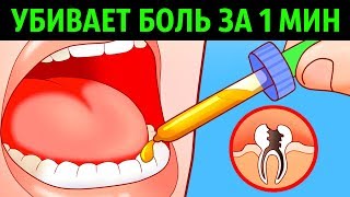 10 Способов Убить Зубную Боль за Минуту [upl. by Eesdnyl]