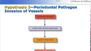 7 Etiology of periodontal diseases1Local factorsDr Wadhah Periodontology lecturesدوضاح الحاج [upl. by Iot]