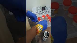 urinetest strip shorts lab video creator shortfeed viral medicalstudent labtechnicians [upl. by Oniotna]