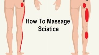 How To Reduce Sciatica Pain with Massage Trigger Point [upl. by Eelinnej]