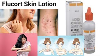 flucort skin lotion uses in hindi  Fluocinolone 001  wv lotion benefits uses side effects [upl. by Adnir]