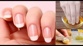 ASTUCE FAIRE POUSSER SES ONGLES PLUS VITE [upl. by Lexie]