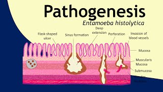 Pathogenesis of Entamoeba histolytica  parasitology  Basic Science Series [upl. by Ecnerat]